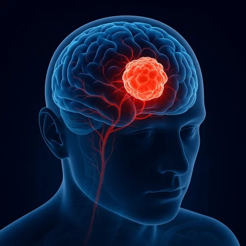 imagem_tumores_cerebrais imagem_tumores_cerebrais